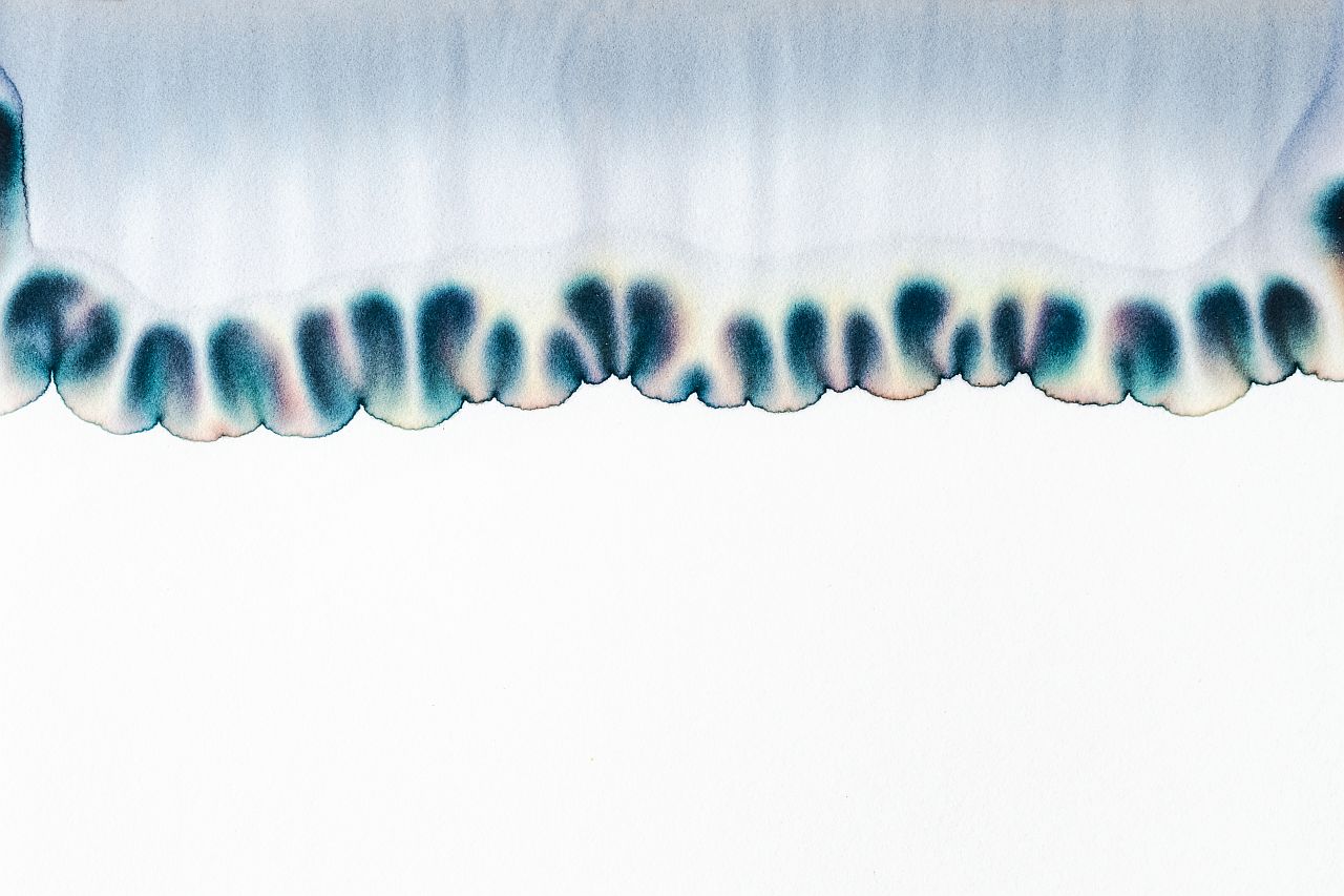 Czym jest smegma - dlaczego powstaje w miejscach intymnych?